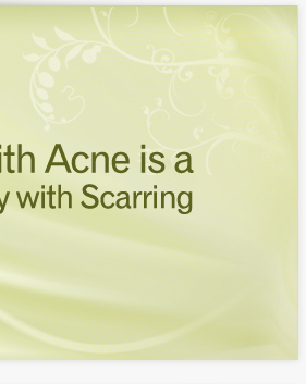 Every Day with Acne is a Day with Scarring - Resnik Skin Institute
